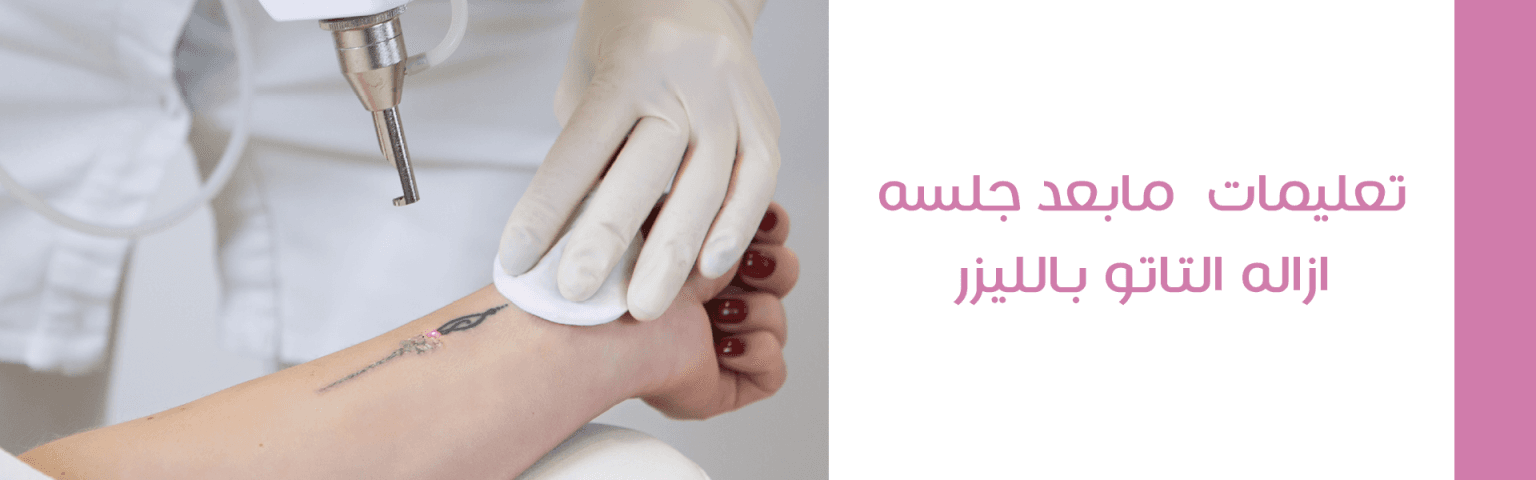 جلسة إزالة التاتو (3سم)