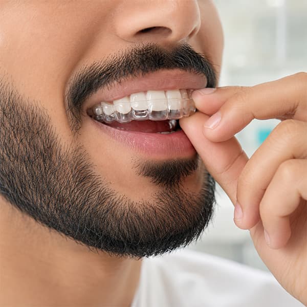 تقويم الاسنان الشفاف