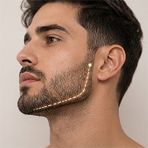 جلسة ليزر تحديد ذقن